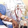 Dialysis crisis in Ghana: A call for government's intervention and philanthropic support