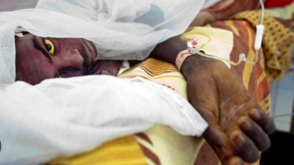 Cerebrospinal Meningitis